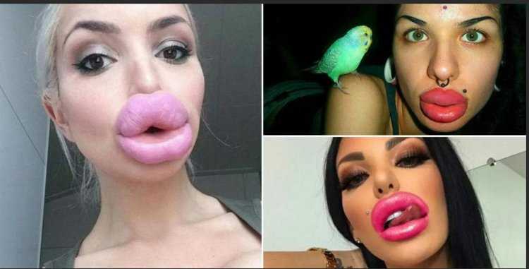 Губастые актеры россии6