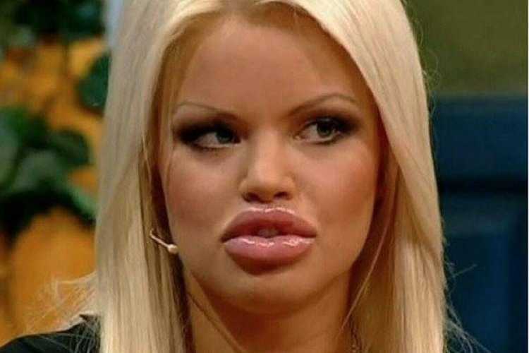 Губастые актеры россии43