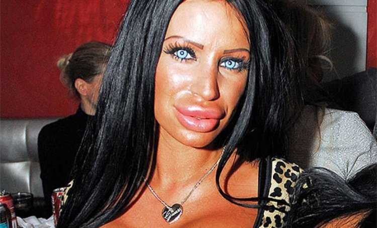 Губошлепка Кайли