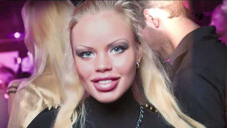 Олеся Малибу губы