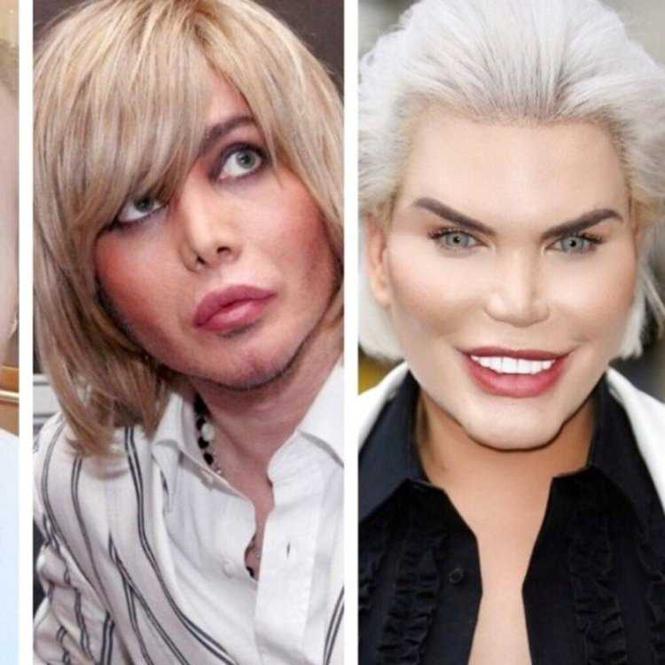 Мужик с пластическими операциями