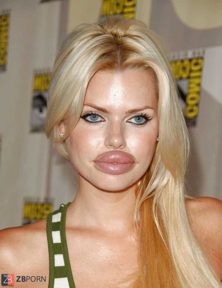 Софи Монк до пластики