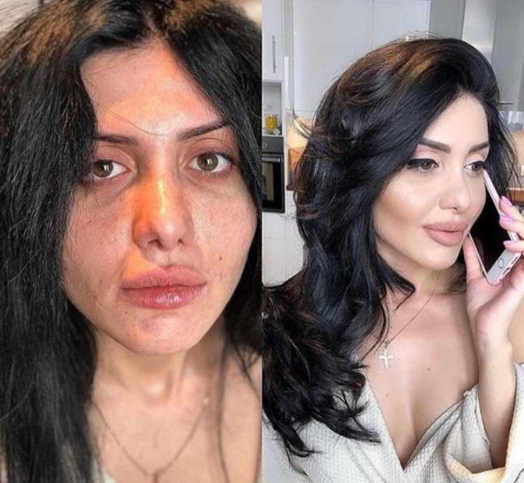 Косметолог Оксана Овсепян