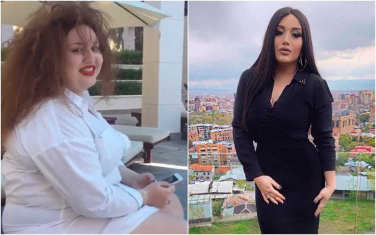 Гоар Аветисян до похудения