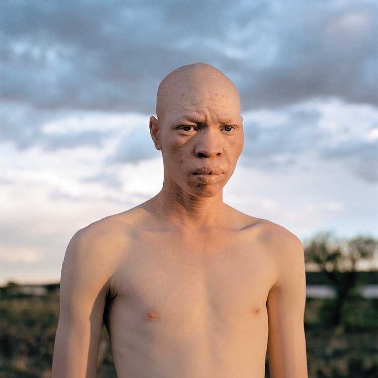 Монгол альбинос