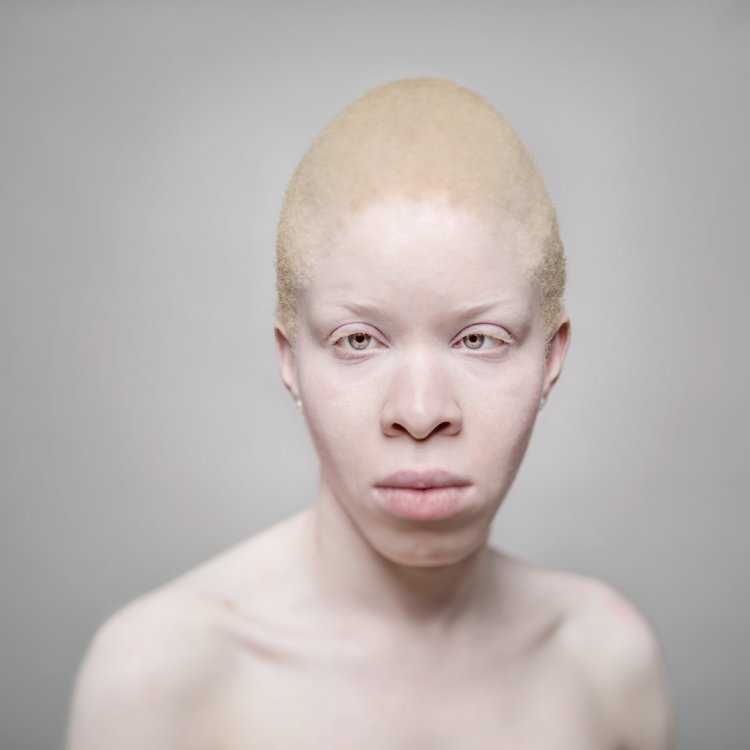 Афроазиат альбинос