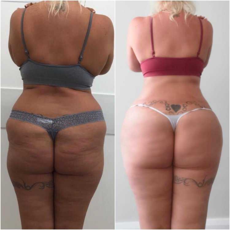 Анастасия Квитко ягодицы