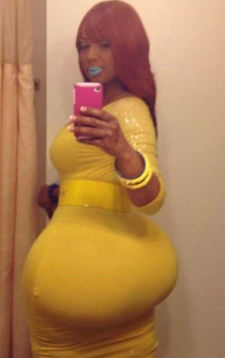 Силикон в ягодицах