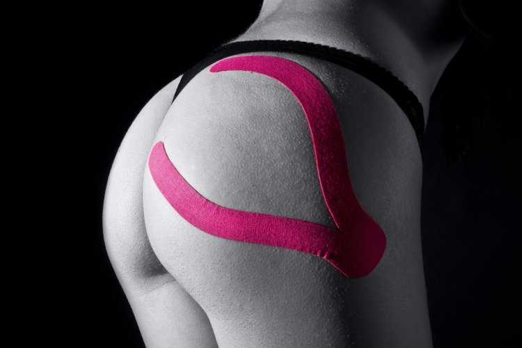 Тейпирование средней ягодичной мышцы