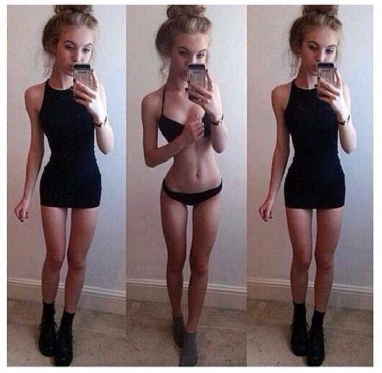 Мария Жолобова анорексия