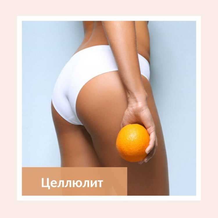 Попа без целлюлита