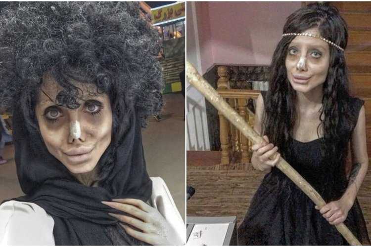 Сахар табар до пластики