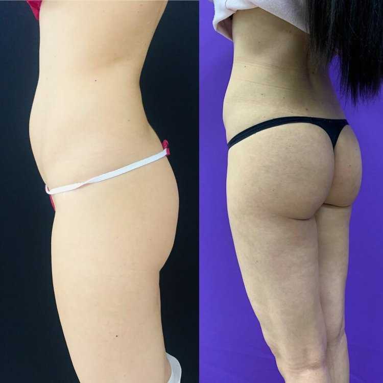 Небольшие круглые ягодицы