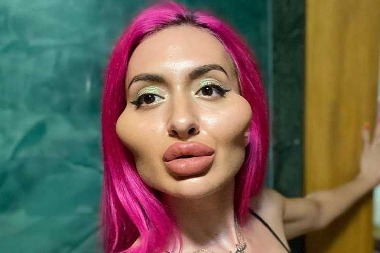 Женщина с накаченными губами и скулами