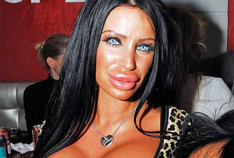 Силиконовые губы