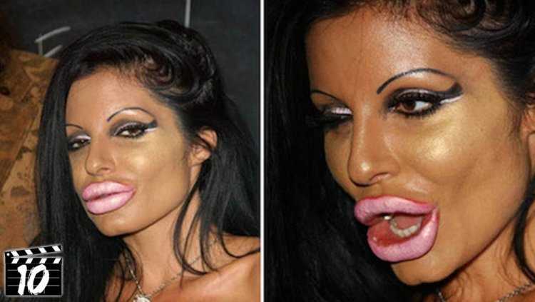 Звезды с надутыми губами