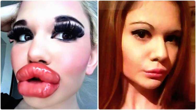 Самые губастые звезды19