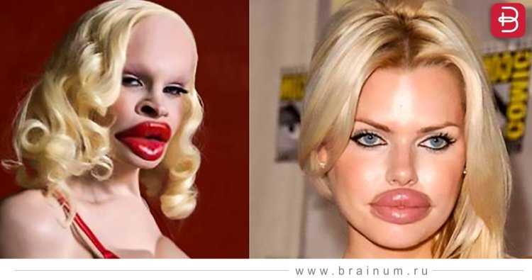 Девушки с пластическими операциями