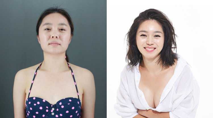 Пластические операции в Азии