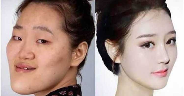 Каннамские красотки в Корее до и после пластики