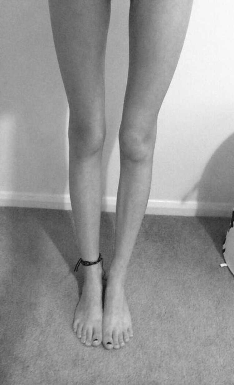 Худые ноги
