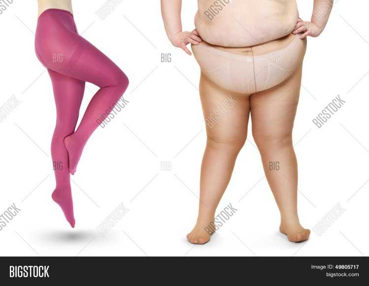 Женские бедра с излишним весом