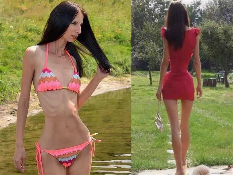 Катя Андреева Анорексичка модель