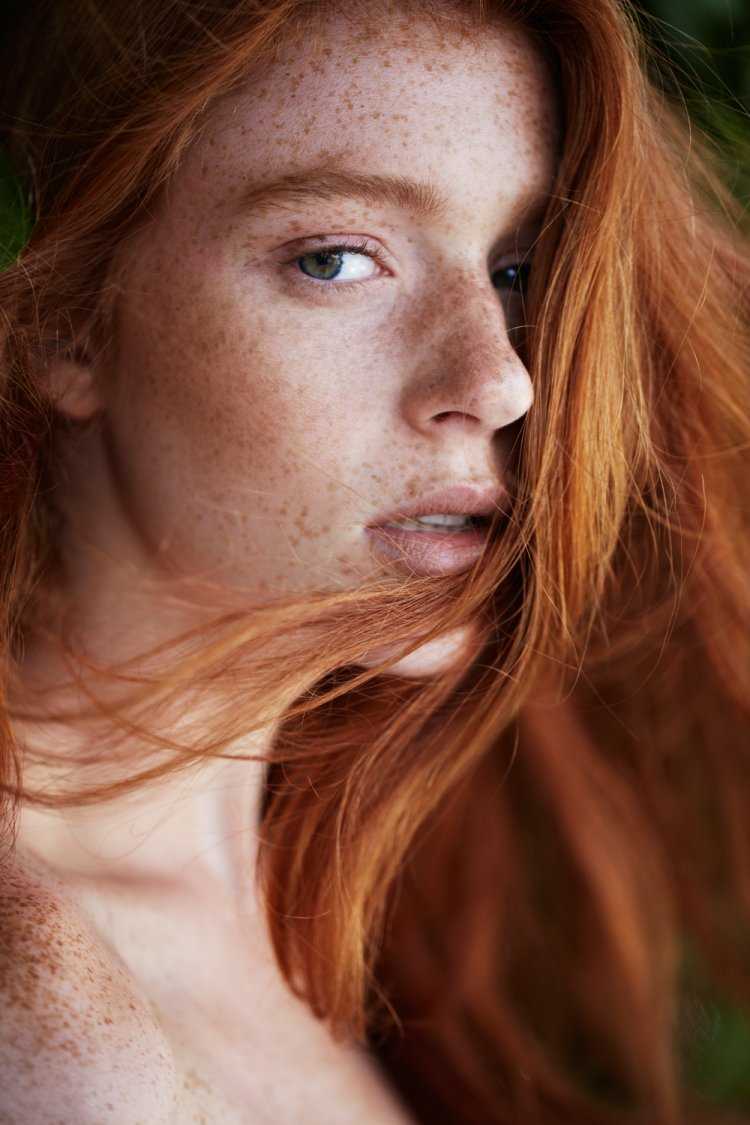 Freckles Оливия