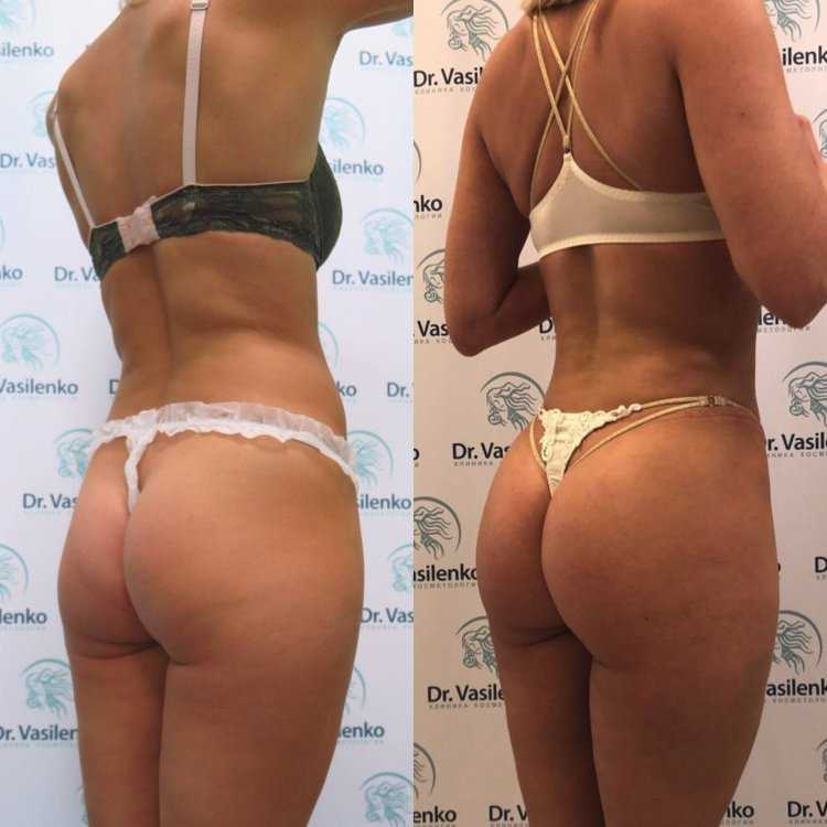 Анастасия Квитко Bikini