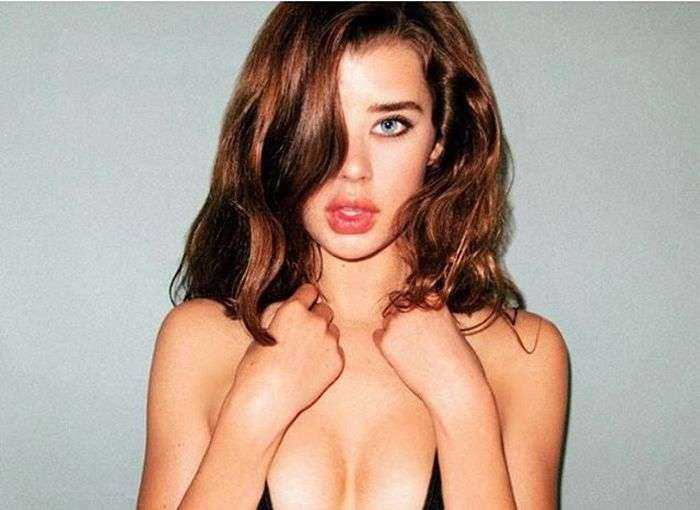 Американка с глазами разного цвета