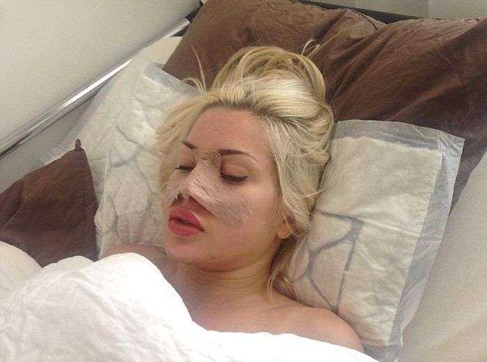 Очередная любительница пластических операций