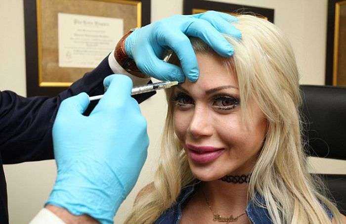 Очередная любительница пластических операций