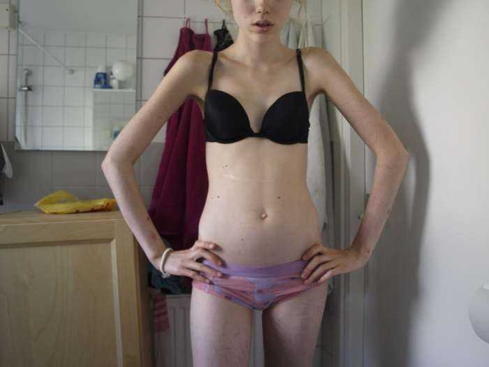 Тощие девушки на фото