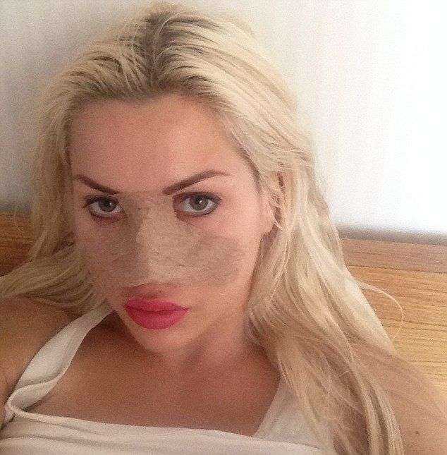 Очередная любительница пластических операций