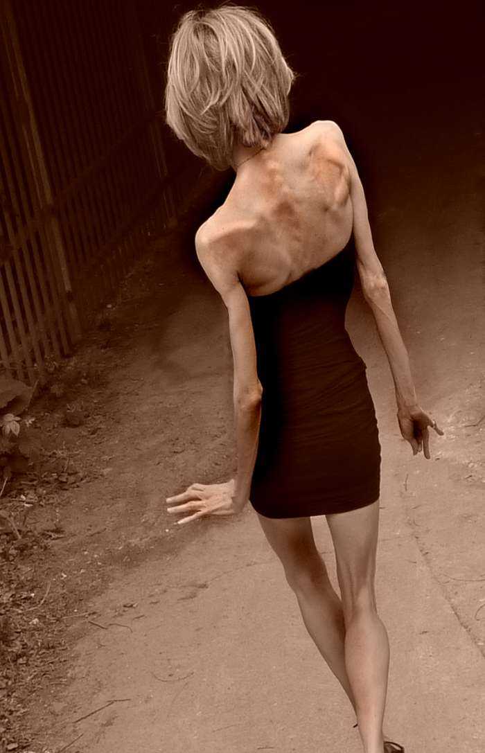 Тощие девушки на фото